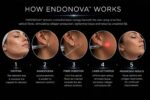 ENDONOVA - Image 6