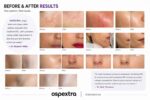 OSPEXTRA - Image 6
